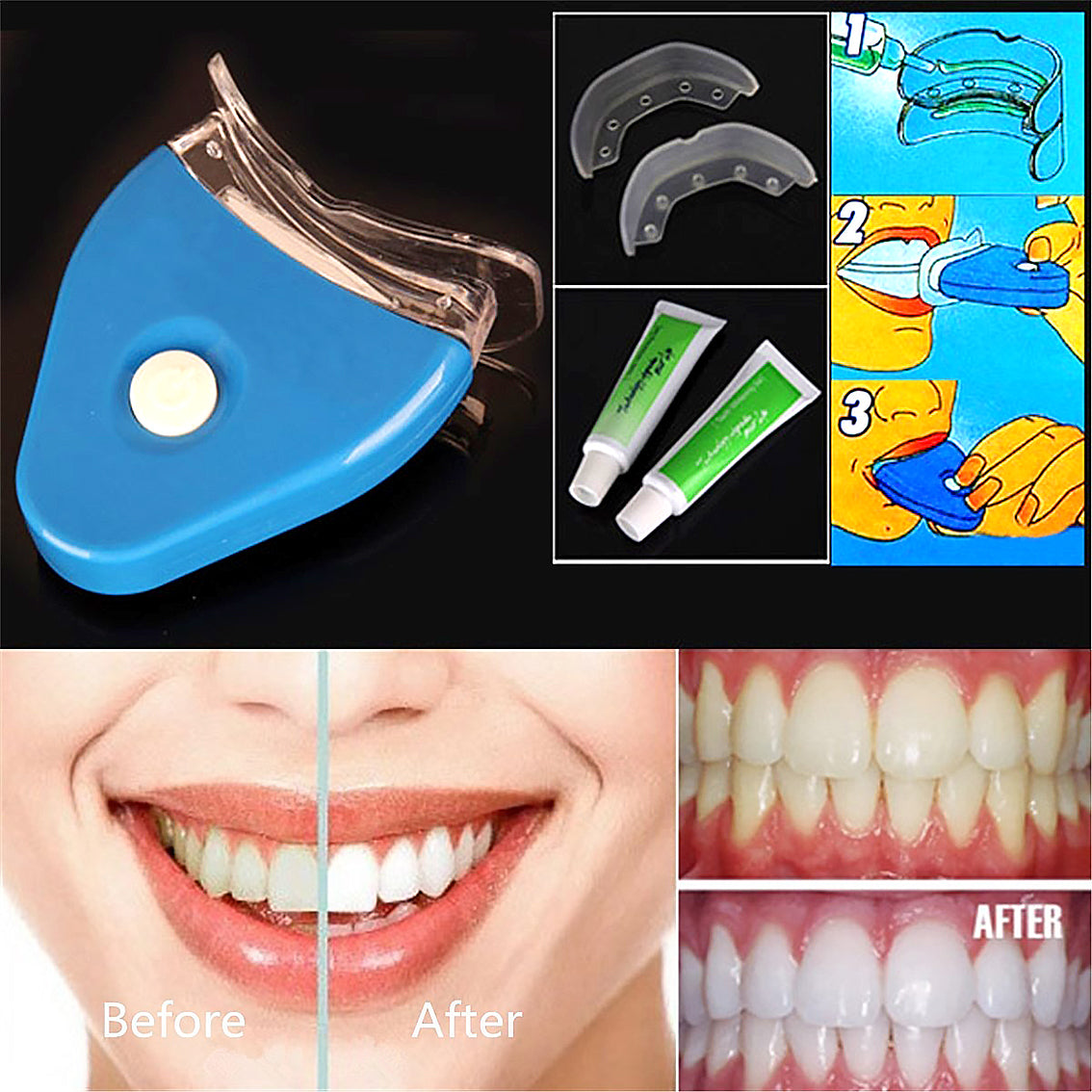 LED Teeth Whitening Kit with Whitening Gel